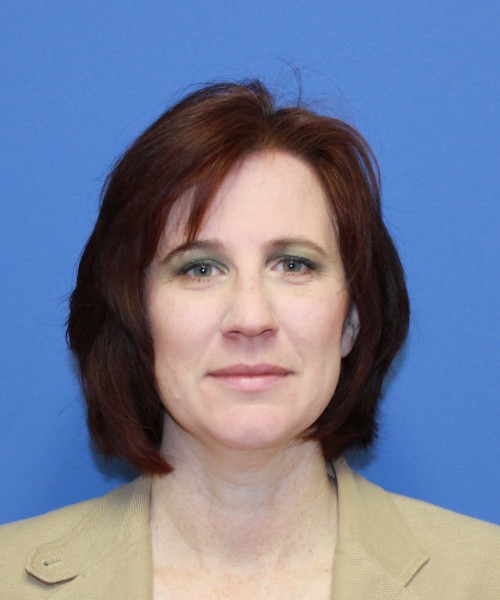 Rhinoplasty 1265 – Click HERE for more views before photo. Individual results may vary.