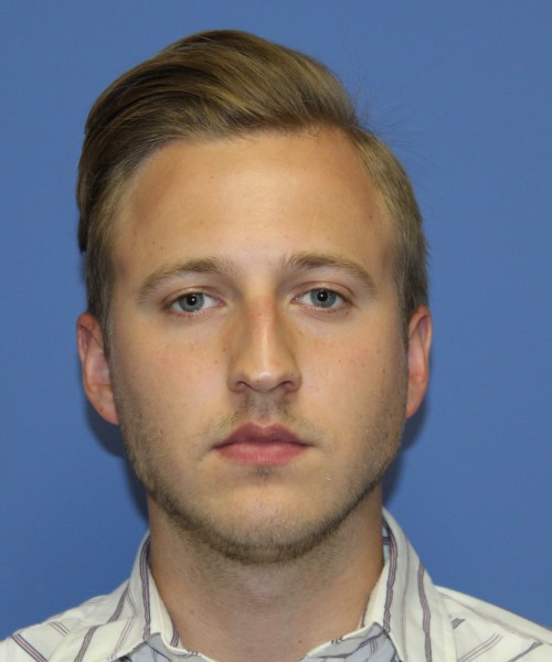 Rhinoplasty 1593 – Click HERE for more views before photo. Individual results may vary.