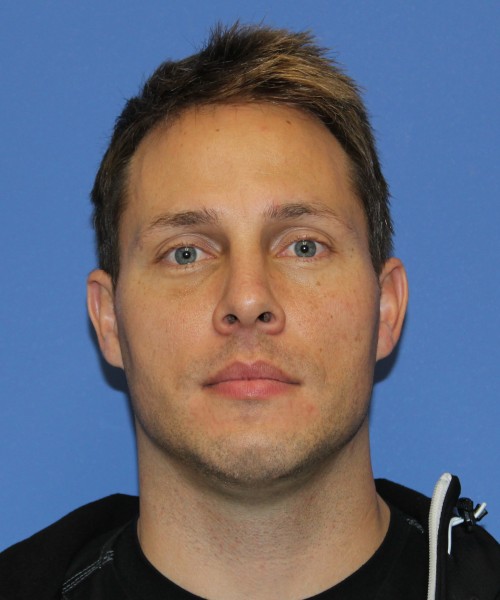 Rhinoplasty 2032 – Click HERE for more views after photo. Individual results may vary.